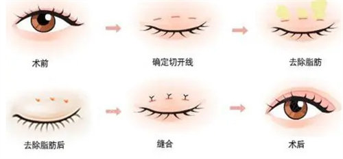 刑事辩解 第877页
