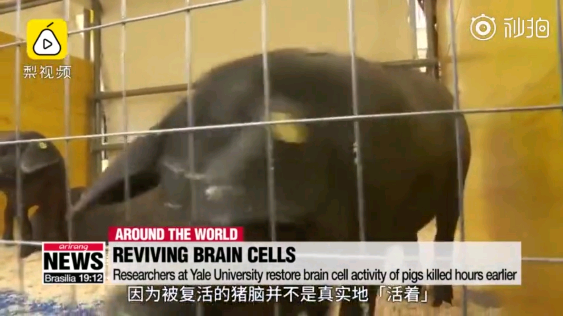 美国男子脑死亡后奇迹复活的全面步骤指南
